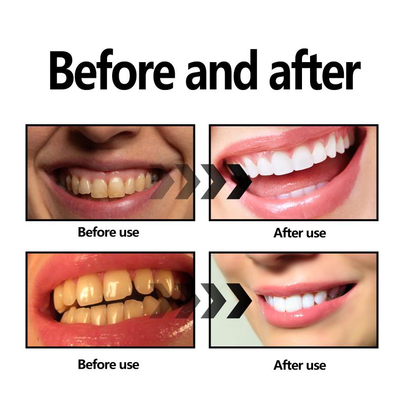 Teeth Whitening Powder Charcoa - Teeth Whitening Baking Soda 评论和价格