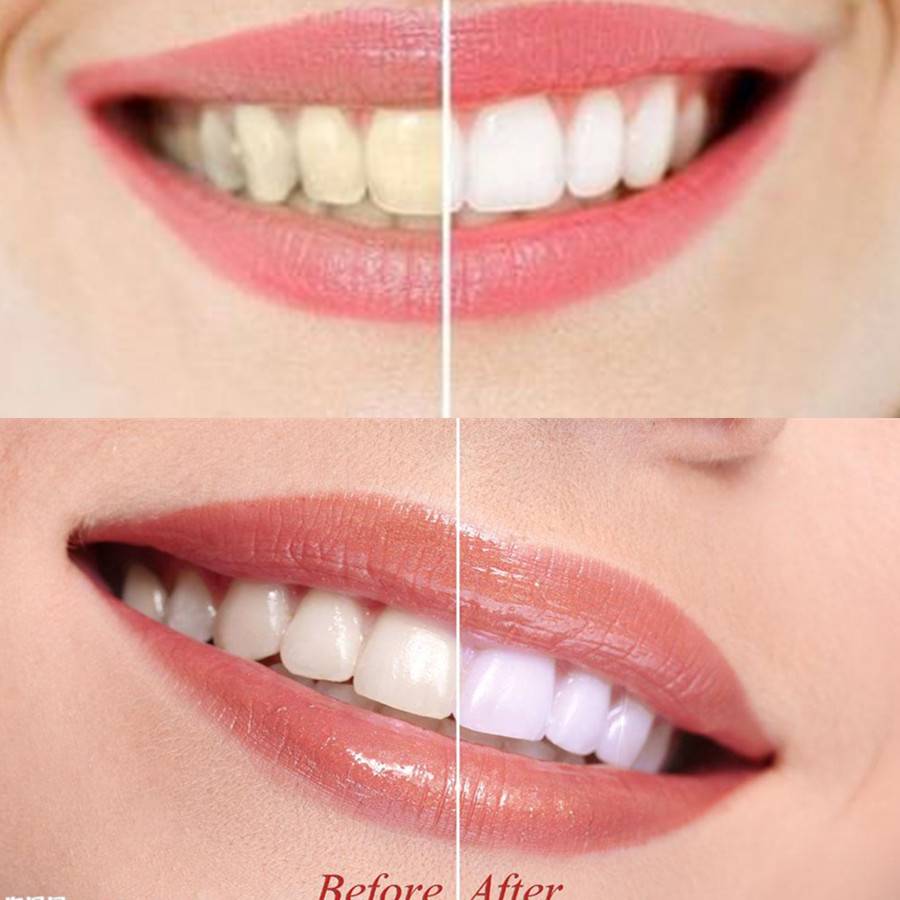 Bamboo Charcoal Teeth Tooth De - Teeth Whitening Q&M 评论和价格