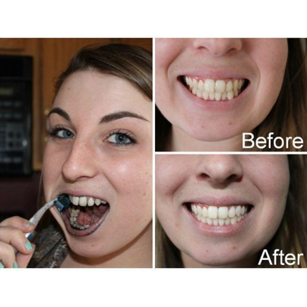 Bamboo Charcoal Teeth Tooth De - Teeth Whitening Q&M 评论和价格