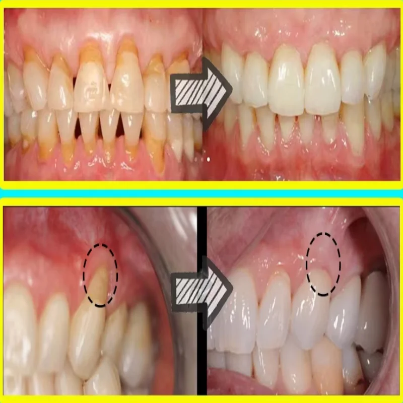Quickly Repair Gum Serum Relie - Teeth Whitening Baking Soda 评论和价格