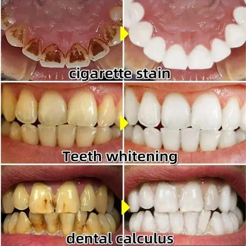 Quickly Repair Gum Serum Relie - Teeth Whitening Baking Soda 评论和价格