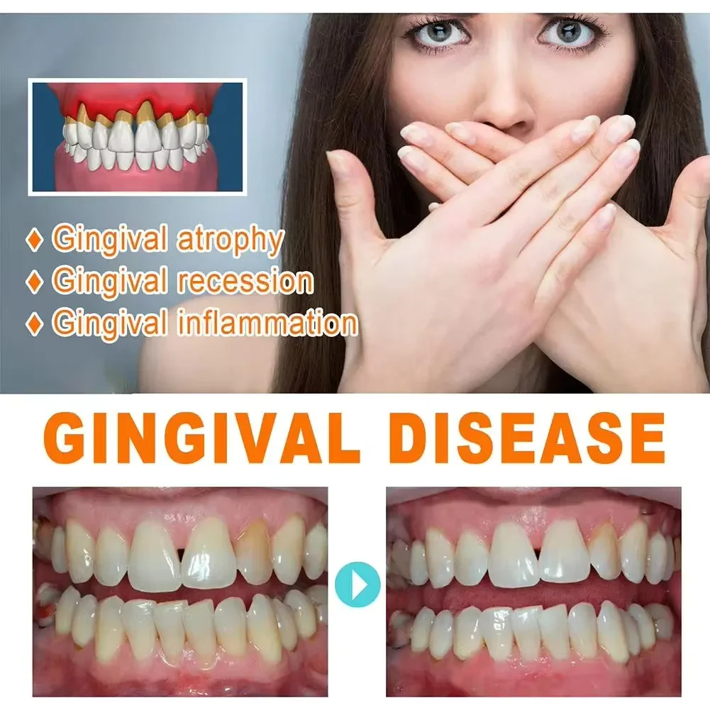 Quickly Repair Gum Serum Relie - Teeth Whitening Baking Soda 评论和价格