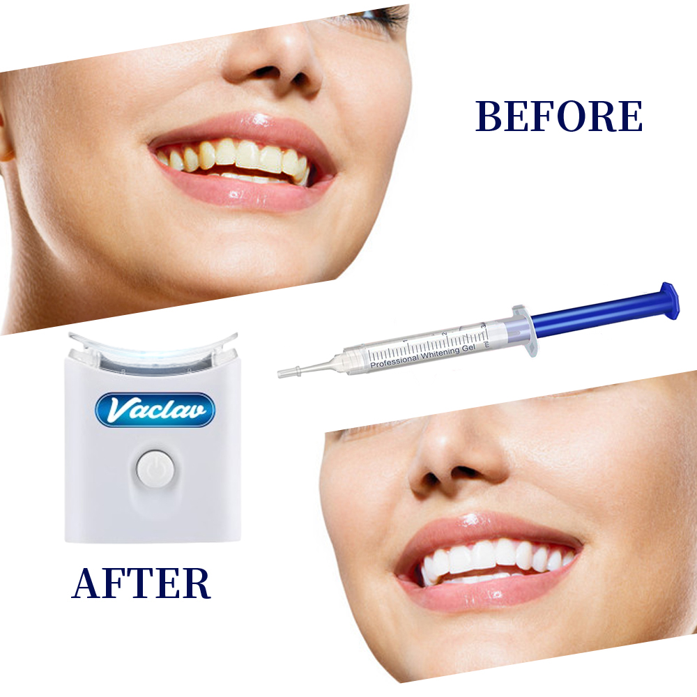 Mint Teeth Whitening Gel Syrin - Teeth Whitening Baking Soda 评论和价格