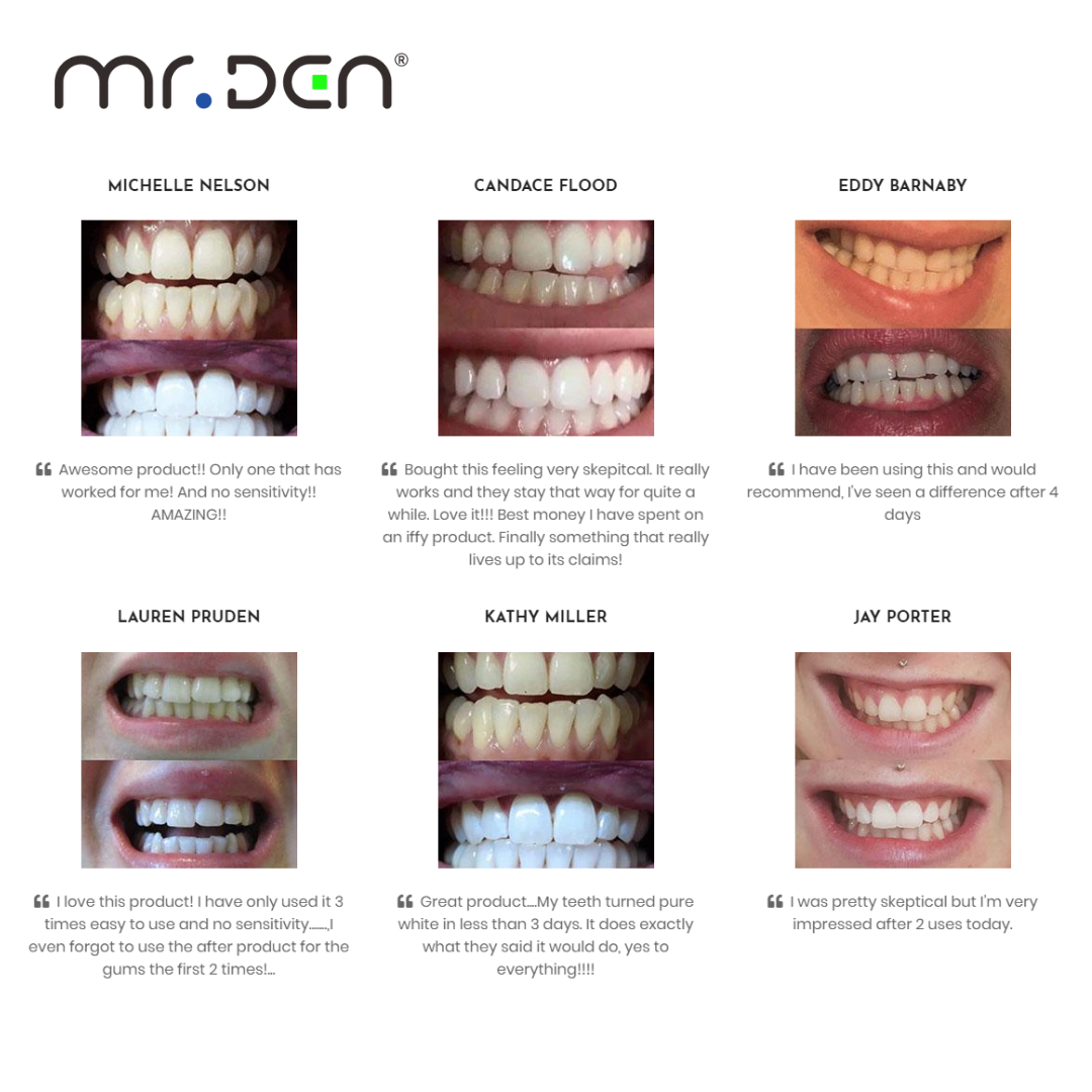 Dr. Whiten 3 Pack Teeth Whiten - Teeth Whitening Professional 评论和价格