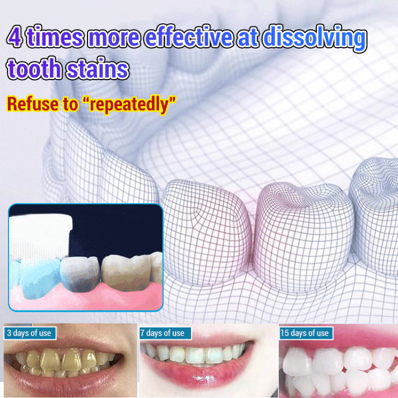 Baking Soda Whiten Teeth Fresh - Teeth Whitening Baking Soda 评论和价格