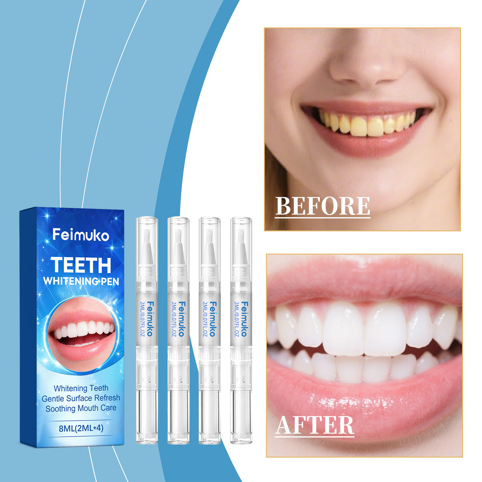 Feimuko 8ml Teeth Gel Pen Gent - Teeth Whitening Q&M 评论和价格