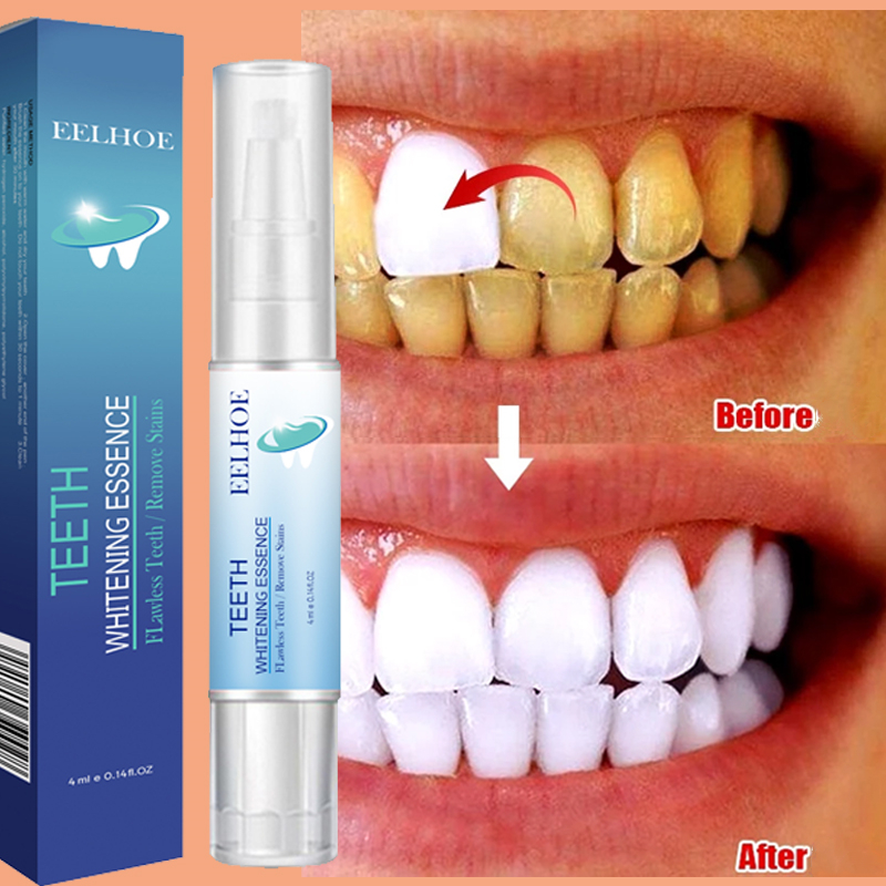 Teeth Whitening Pen Dental Ess - Teeth Whitening Bleaching Kit 评论和价格