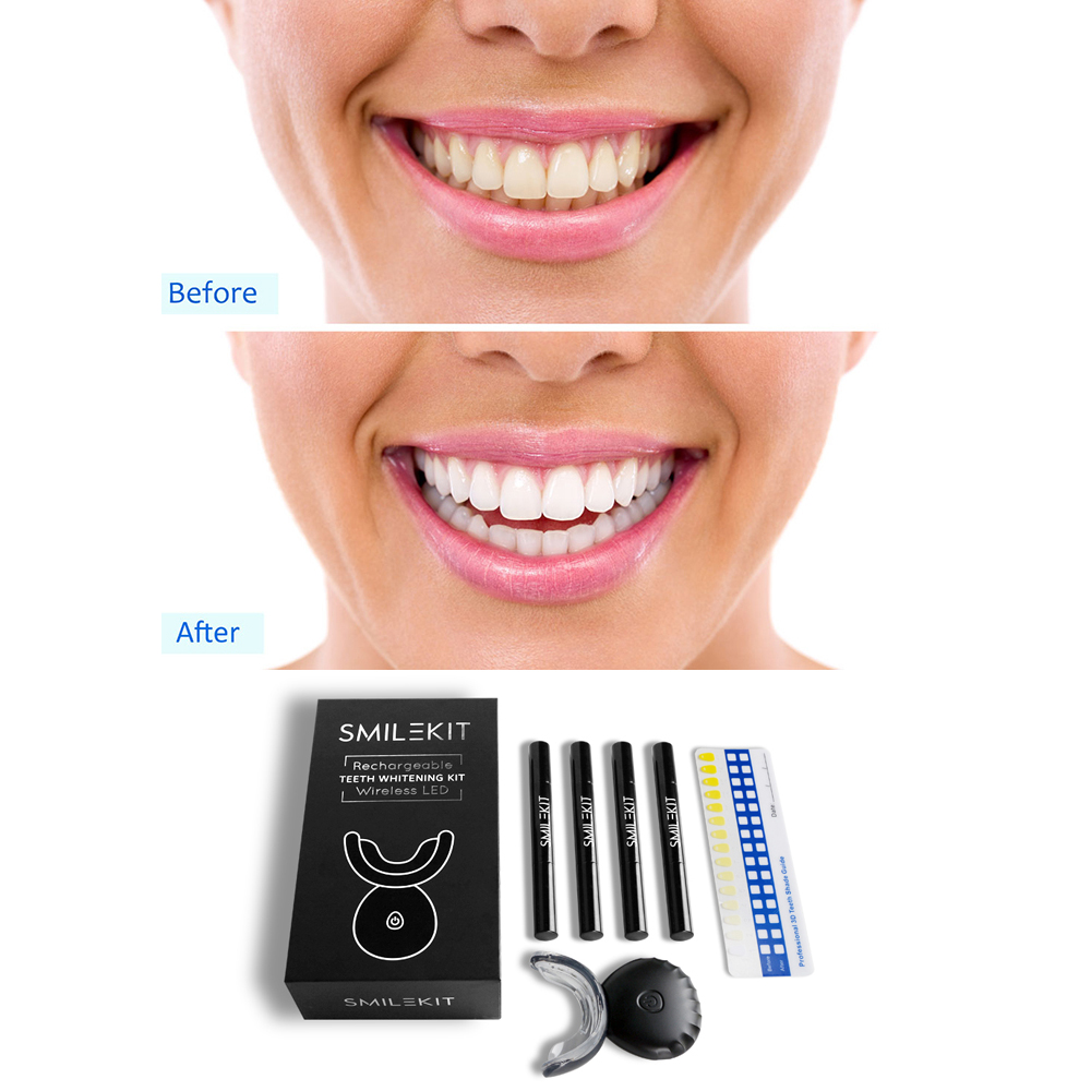 New Electric Teeth Whitening L - Teeth Whitening Bleaching Kit 评论和价格