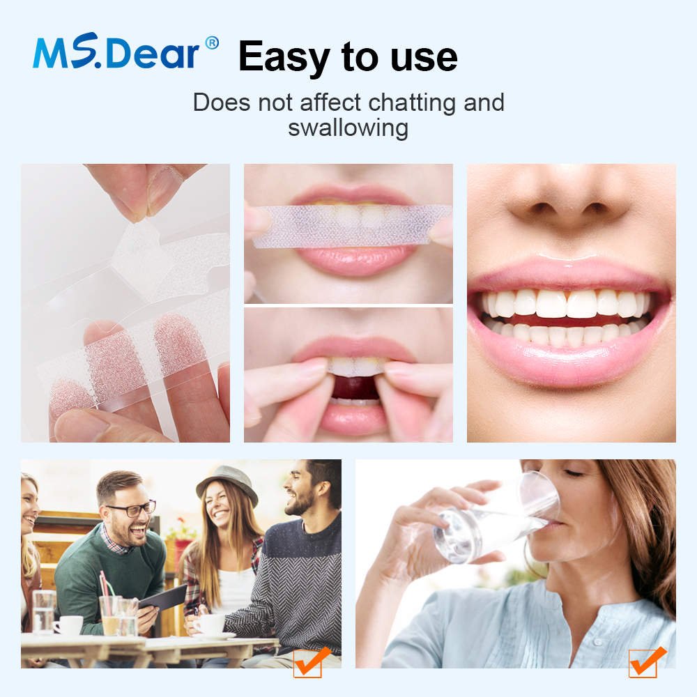 Teeth Whitening Strips Cleansi - Teeth Whitening Paste 评论和价格